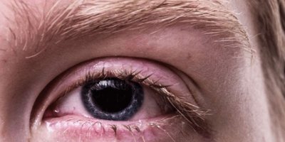 Adenovirüs kovid-19 kadar hızlı yayılabiliyor