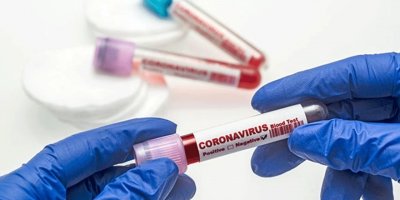 Akdoğan’da berberin testi pozitif çıktı