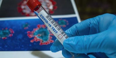 Güney Kıbrıs’ta Koronavirüs vakaları istikrarlı yükselişte