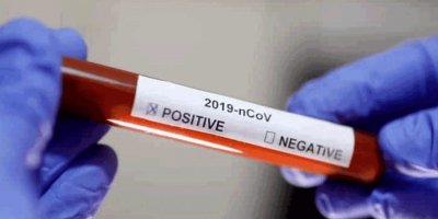 Mustafa Yüncü Lefkonuklu LTD'de pozitif vaka