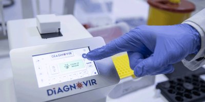 Türk Bilim insanları koronavirüs teşhisini 10 saniyeye düşüren tanı sistemi geliştirdi