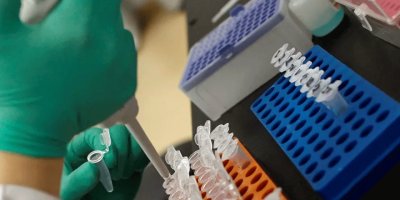 'Koronavirüs, down sendromlularda 10 kat daha ölümcül'