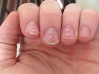 Tırnaklardaki beyaz lekelere dikkat!