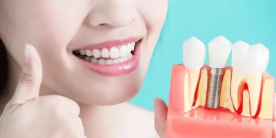 Güney Kore menşeli 'implantlar'a damping soruşturması