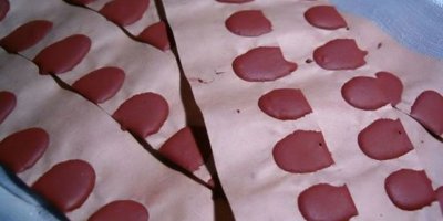 Çatapatla Üç Parmağını Kaybetti