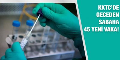 “45 vakanın büyük bir çoğunluğu yerel”