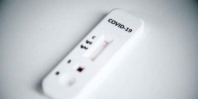 Tabipler: ''Onaylı olmayan hızlı testler kullanılıyor''