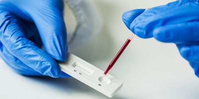 Avrupa Biyoteknoloji Kongresi’nden Yakın Doğu Üniversitesi’ne bir ödül daha