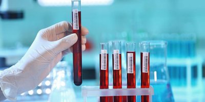 Tahlil ücretlerine %83 zam!