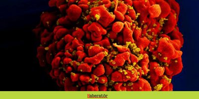 ABD'de bir kadın, kök hücre naklinden sonra HIV'i atlatan üçüncü kişi oldu