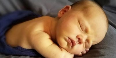 Yenidoğan sarılığı, doğru bir şekilde tedavi edilmezse beyin hasarına yol açabilir