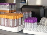 İnmeye karşı kök hücre