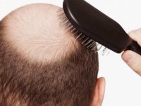 Saç çıkaran tarif!