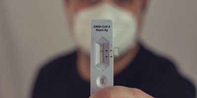 100 bin antijen test kiti alınacak