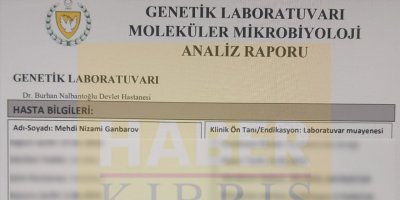 HIV virüsü taşıyan kişiye çalışma izni verildi