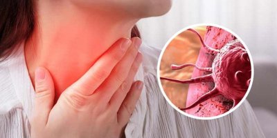 Özkayalar: Lenfoma hastalığı KKTC’de de artış gösterdi