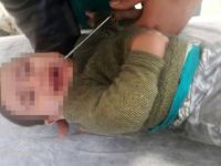 Antalya'da 9 aylık Muhammed'in ağzına kova demiri saplandı