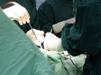 Burundan beyin omurilik sıvısı kaçağı ameliyatı yapıldı