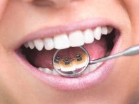 Güzel gülüşlerin sırrı koruyucu ortodonti olabilir!