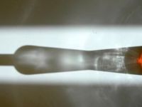 Alkol kök hücrelerinde kalıcı genetik hasara yol açıyor