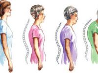 7 vitamin ile kemiklerinizi güçlendirin