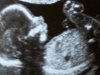 Bebeğin cinsiyeti ne zaman belli olur?