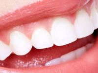 "Üst dişlerdeki enfeksiyonlar sinüzite neden olabilir"