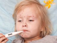 Güney Kıbrıs’ta 2 kızamık vakası...