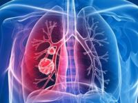 Tedavisi zor nadir hastalıklar masaya yatırıldı