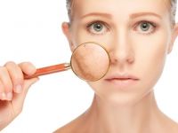 Hastalıklarınızın nedeni cilt lekeleriniz olmasın