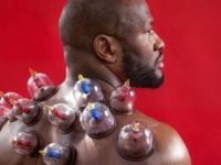 ABD'li futbol yıldızı hacamat ile tedavi oluyor