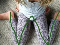 Çocuklarda W şeklinde oturuş zararlı mı?