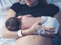 Doğumsal kol felcinin tedavisi var mı? (Obstetrik Brakiyal Pleksus Paralizisi)
