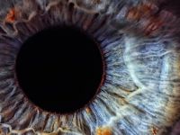 Sarı nokta hastalığı olanlar nasıl beslenmeli?