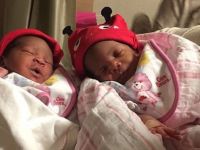 Kongolu çift Ankara'daki tedaviyle ikiz bebek sahibi oldu