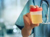 "İdrarda yanma hissi prostat kanseri belirtisi olabilir''