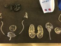 Türk bilim insanları cerrahide 3D teknolojisine imza attı