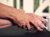 Parkinson bağırsaklarda başlıyor