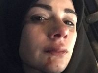 Sosyal Medya Fenomeni Elif Kübra Genç, Darp Edildi