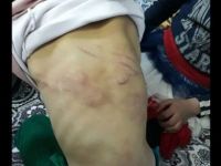 Gaziantep'te babasından işkence gören çocuk yuvaya yerleştirildi