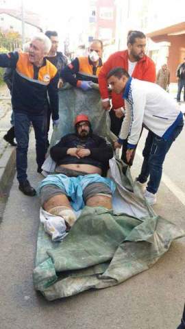 fil-hastaligi1.jpg